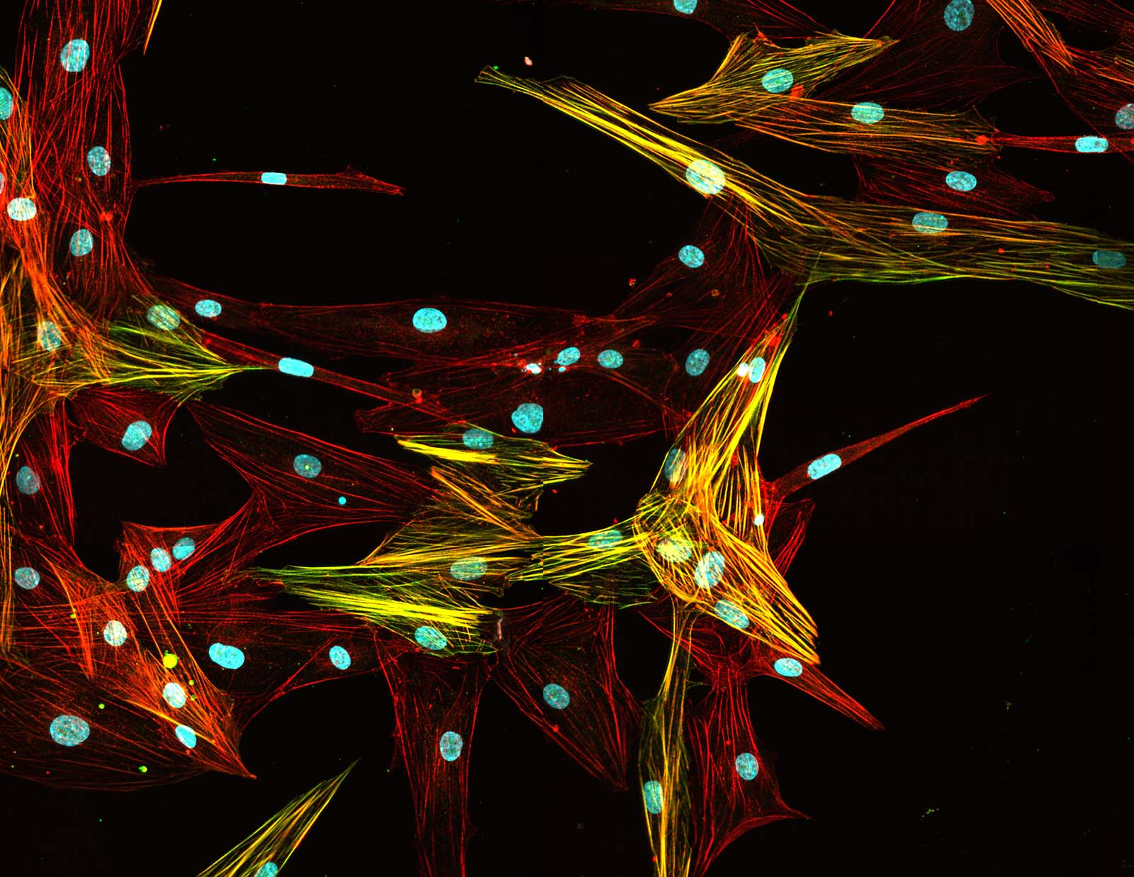 Crisp Cell Paint Photo Photography Crisp Cell Paint Photo Photography